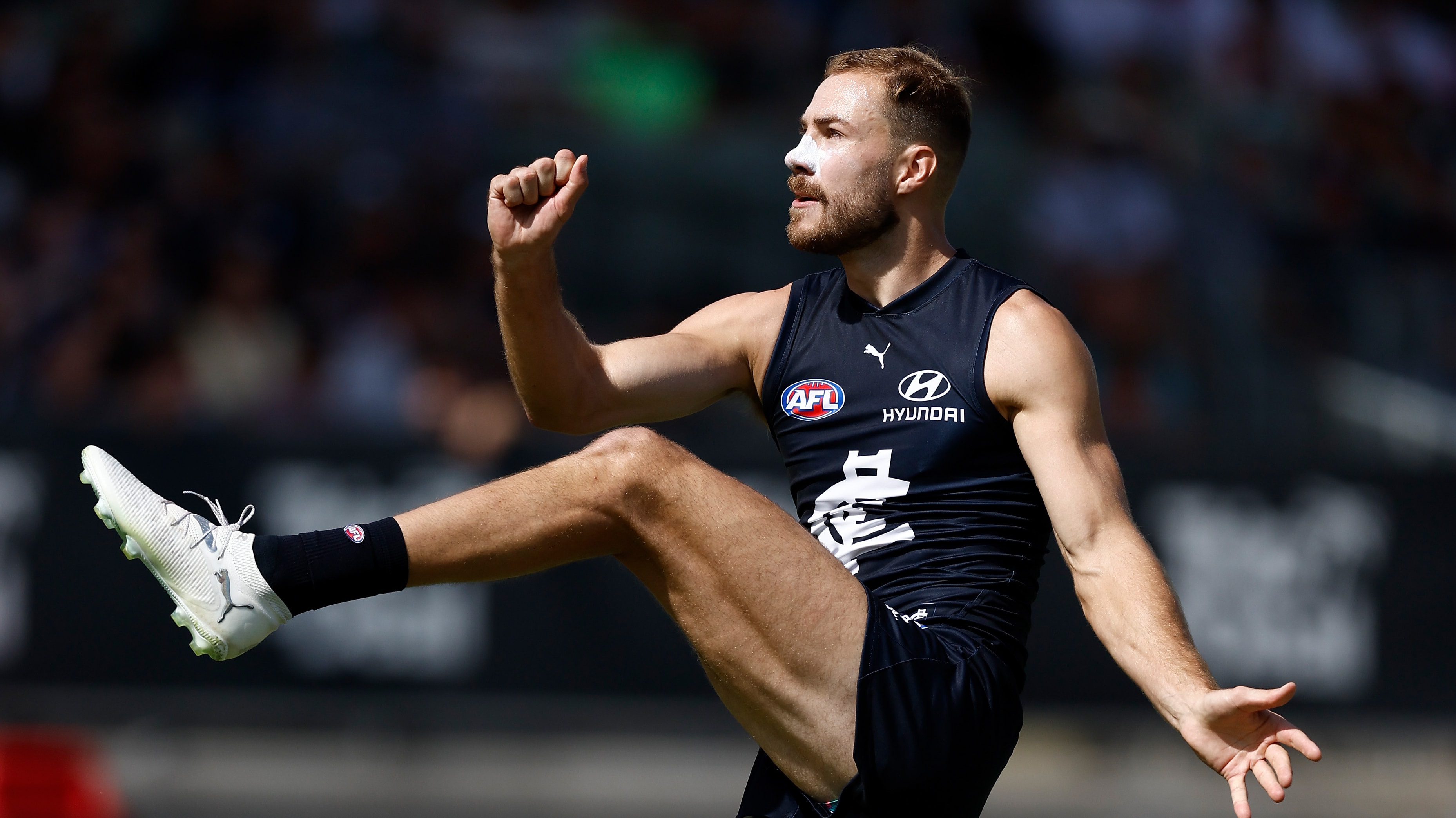 Friday Night Football: McKay's Absence Confirmed